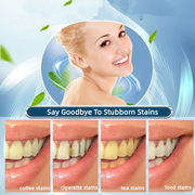 50g Tooth Whitening Powder Probiotics Toothpaste Tartar Stain Removal Tooth Care
