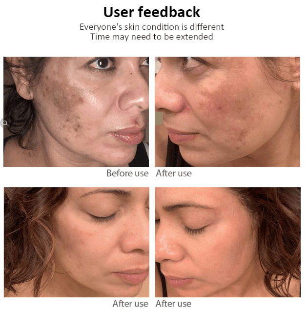 Dr.Hancy Whitening Freckle Cream  Dark Spots Face Moisturizing Face Skin Care