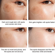Whitening Freckle Cream  Dark Spots Face Moisturizing Dr.Hancy  Skin Care