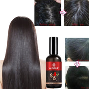 Hair Growth Nutrient Solution For Thinning Hair
