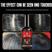 Hair Growth Nutrient Solution For Thinning Hair