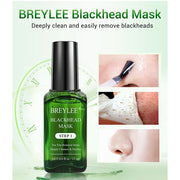 Treatment Shrinks Pore Peel Off
