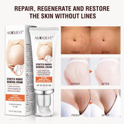 TikTok Maternity Stretch Marks Removal Cream   Scar Remover Cream
