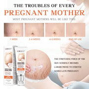 TikTok Maternity Stretch Marks Removal Cream   Scar Remover Cream