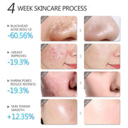 TikTok Facial Mask- Shrink Whitening Mask Face Skin Care